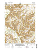 Erwin Illinois Current topographic map, 1:24000 scale, 7.5 X 7.5 Minute, Year 2015