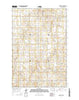 Appert Lake North Dakota Current topographic map, 1:24000 scale, 7.5 X 7.5 Minute, Year 2014
